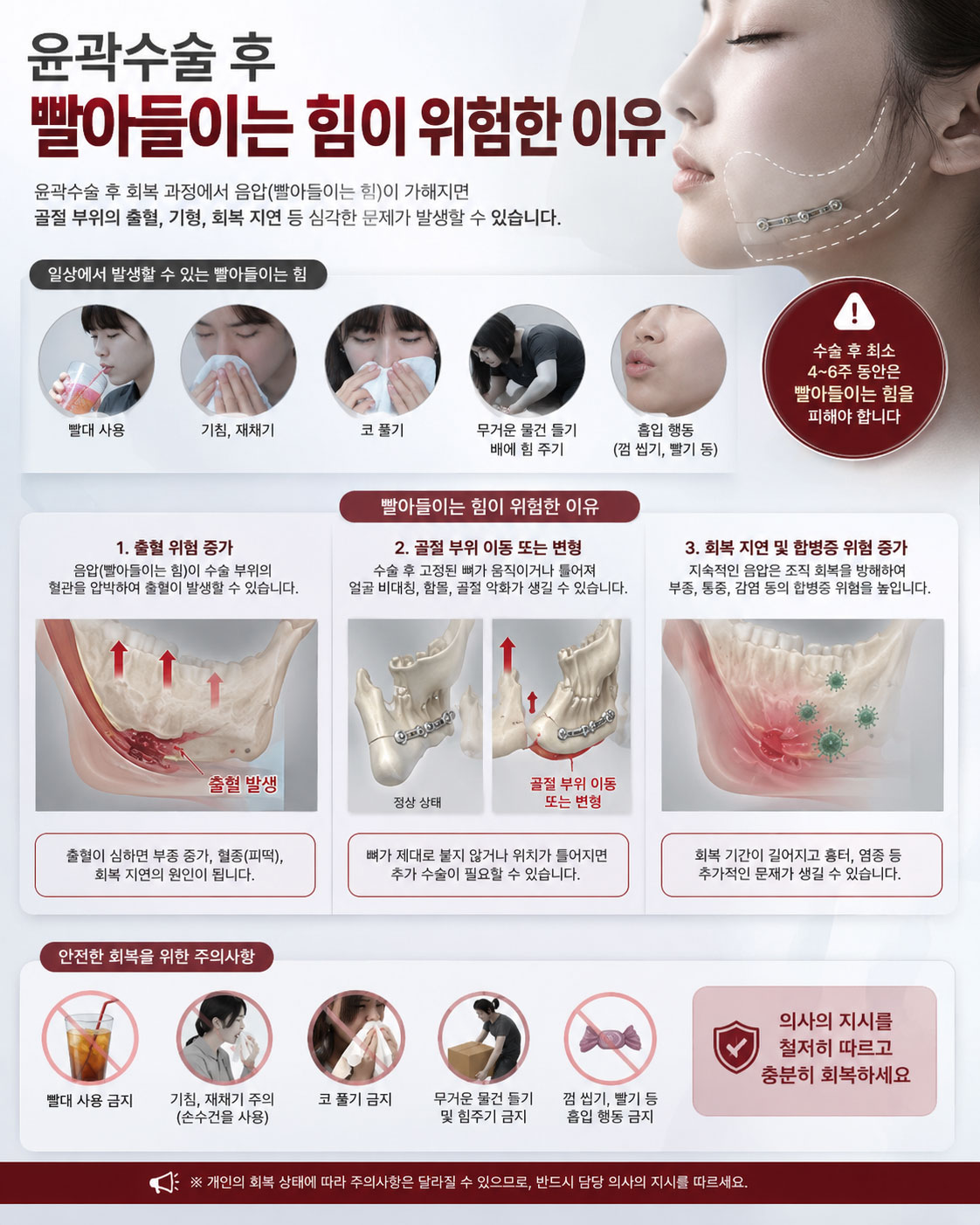 윤곽수술 후 키스 시 구강 내 절개창에 음압(빨아들이는 힘)이 가해져 봉합부가 벌어지는 원리를 설명하는 이미지