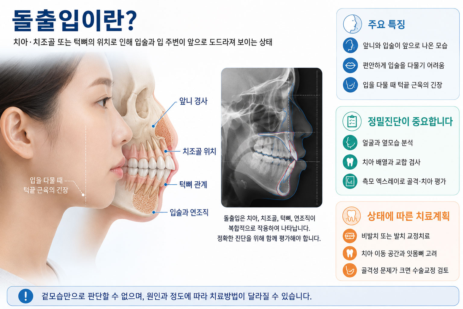 돌출입 설명 이미지 — 치아만 앞으로 기운 경우와 잇몸뼈·턱뼈까지 돌출된 경우를 옆모습으로 비교해 교정과 수술의 판단 기준을 보여주는 그림