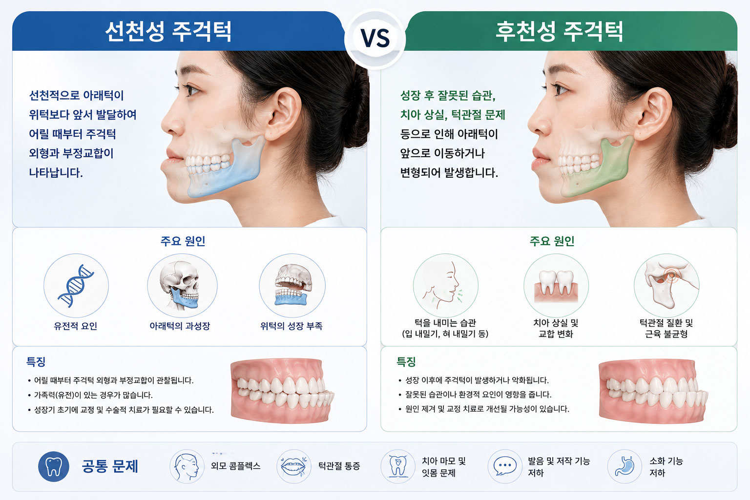 주걱턱 유전 — 선천성 vs 후천성 원인 설명 이미지