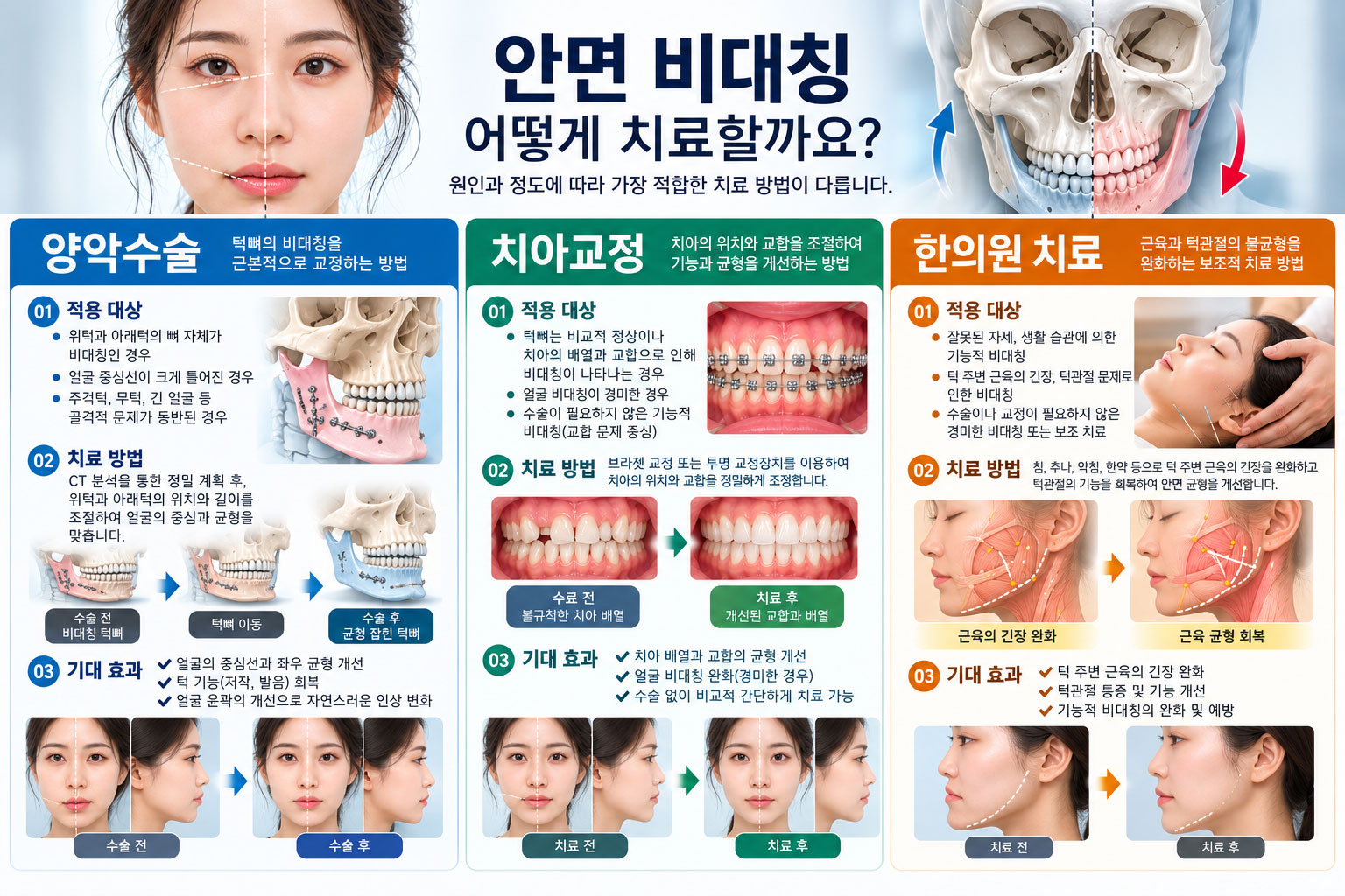 안면 비대칭 치료 방법 비교 이미지 — 골격성 비대칭은 양악수술, 경미한 경우는 치아교정·안면윤곽으로 나뉘며 한의원·마사지로는 뼈를 해결할 수 없음을 보여주는 그림