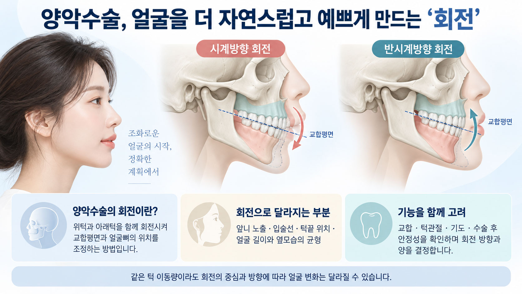 양악수술 회전 설명 이미지 — 아래턱을 그냥 넣은 경우와 위·아래턱을 시계방향으로 회전한 경우의 옆모습 차이를 비교해 중안면 볼륨과 갸름한 턱선을 보여주는 그림